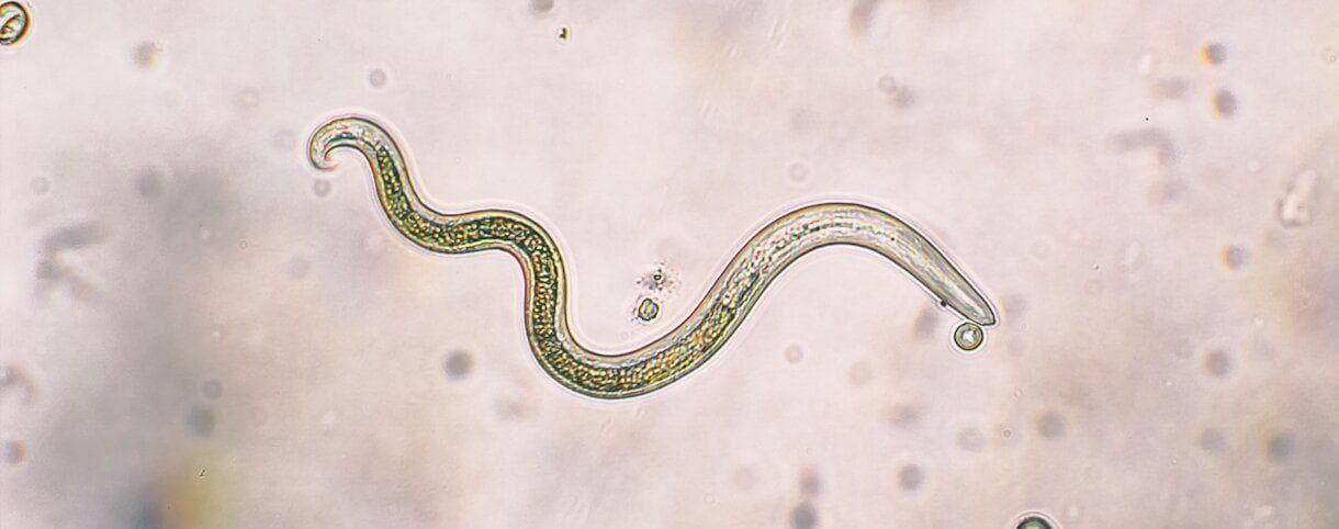 An image of a parasite from a microscope